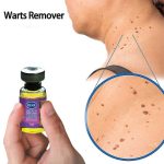 SKIN WART REMOVER - Image 4