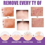 SKIN WART REMOVER - Image 2