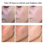 WHITENING FRECKLE CREAM - Image 3