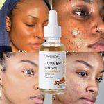 EELHOE TURMERIC OIL - Image 5