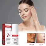DARK SPOT CREAM - Image 5