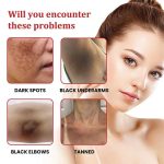 DARK SPOT CREAM - Image 3