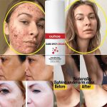 DARK SPOT CREAM - Image 2